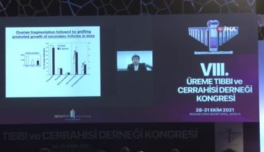 Prof.Dr. Timur Gürgan, “Avrupa’da da kabul gören balanslama tekniği gebeliği yüzde 45 arttırıyor”