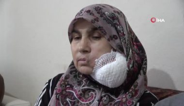 Çaresiz bayan yüzündeki dev kitleden kurtulmak için yardım bekliyor