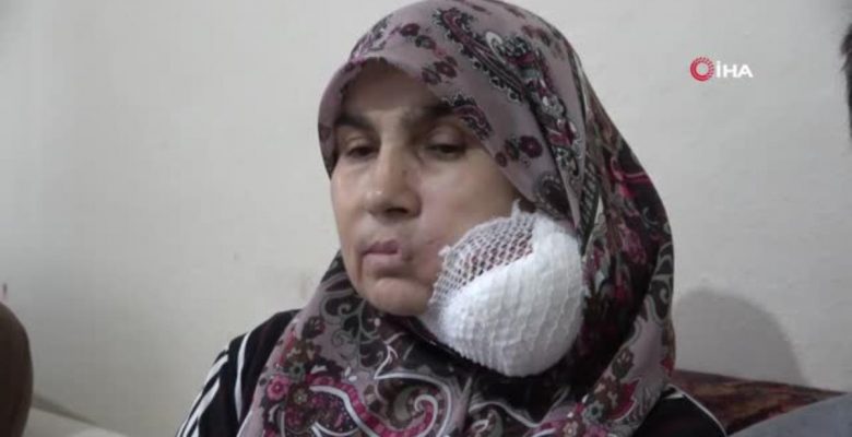 Çaresiz bayan yüzündeki dev kitleden kurtulmak için yardım bekliyor