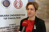 “Covid-19 tomografilerinde akciğer kanseri saptamak mümkün”