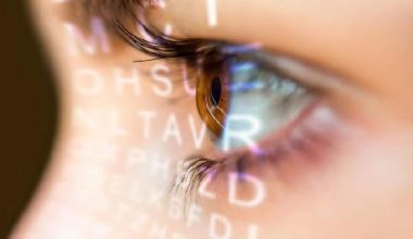 OP. DR. ERTAN SUNAY: HASTA LAZER TEDAVİSİNDEN SONRA GÖZLÜKTEN ÖMÜR UZUNLUĞU KURTULABİLİR