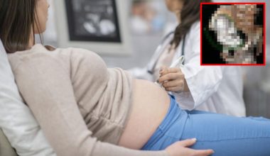 Dünya bu fecî olayı konuşuyor! Bayanın ultrason imajına bakan hekim çabucak yetkilileri aradı