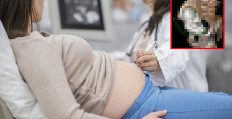 Dünya bu fecî olayı konuşuyor! Bayanın ultrason imajına bakan hekim çabucak yetkilileri aradı