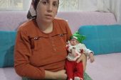 Minik Hamza Ali dünyadaki 3. hadise olarak literatüre girecek