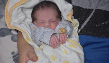 Minik Hamza Ali dünyadaki 3’üncü hadise olarak literatüre girecek (2)